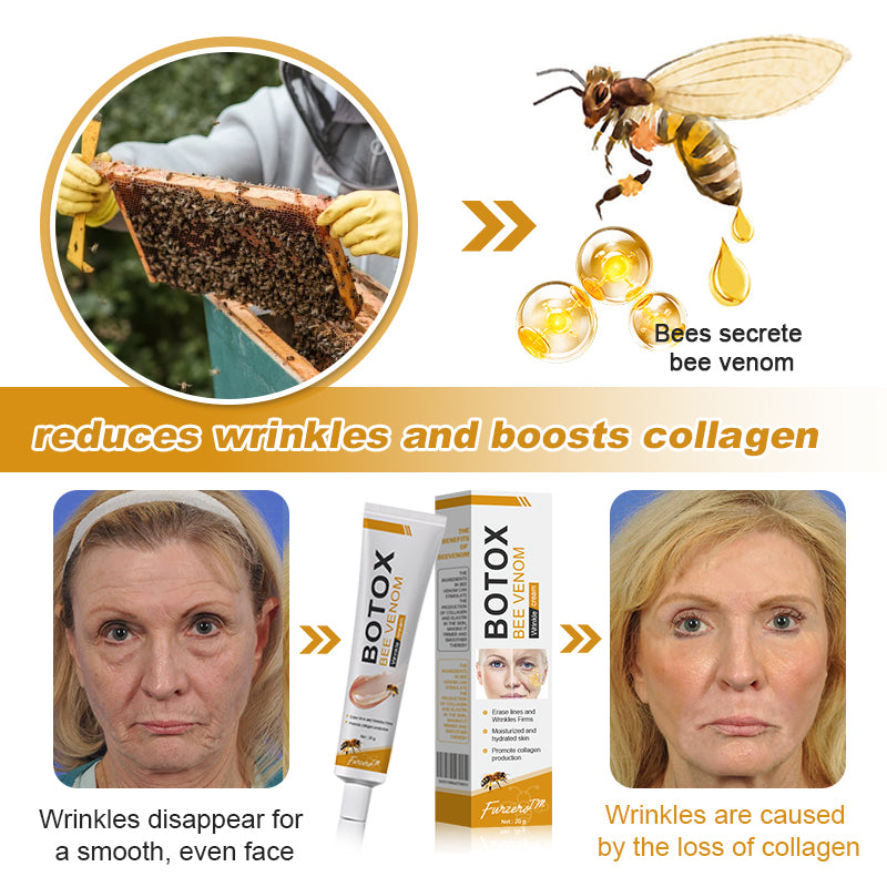 💫🍀Made and shipped from Canada✅ Furzero™ Botox Bee Venom Wrinkle Removal Cream- LAST DAY 70% OFF
