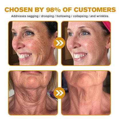 💫🍀Made and shipped from Canada✅ Furzero™ Botox Bee Venom Wrinkle Removal Cream- LAST DAY 70% OFF
