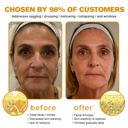 💫🍀Made and shipped from Canada✅ Furzero™ Botox Bee Venom Wrinkle Removal Cream- LAST DAY 70% OFF